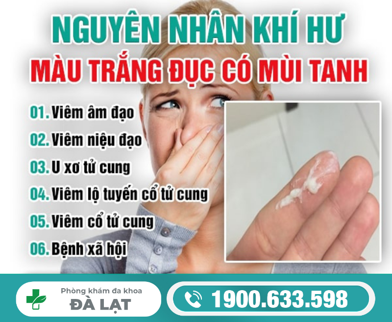 Hình ảnh minh họa